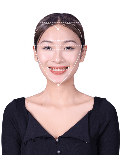 img-boc-rang-su-2-3-25-min